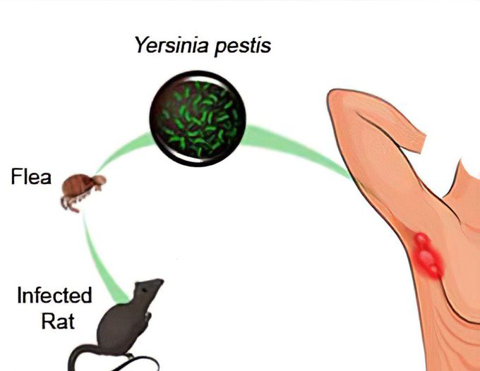 Cause of Bubonic Plague