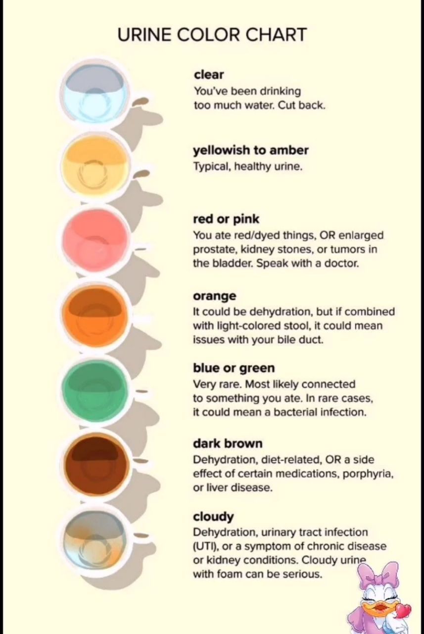 urine color cirrhosis