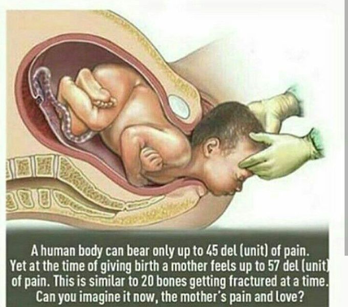 Pain during pregnancy