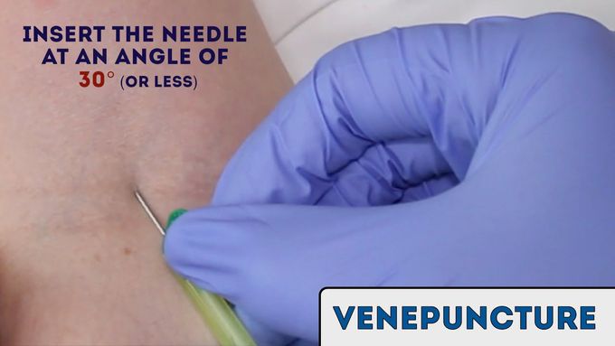 Venepuncture - How to take a blood sample?