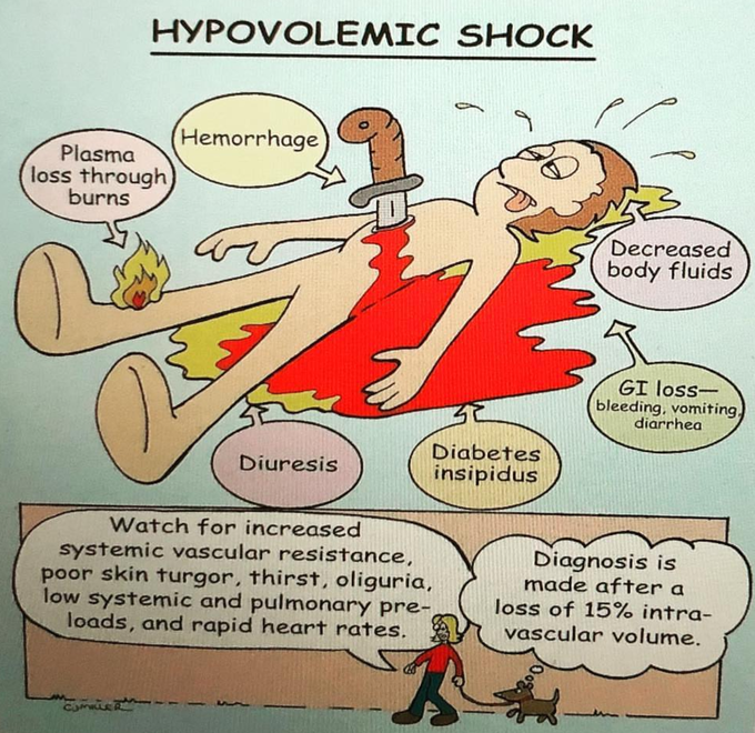 Hypovolemic shock