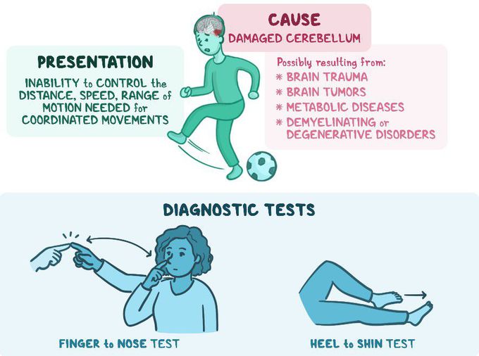 Treatment for Ataxia - MEDizzy