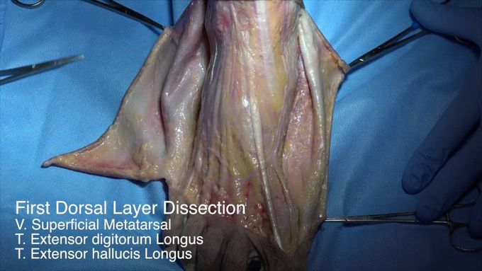 Foot Dissection
