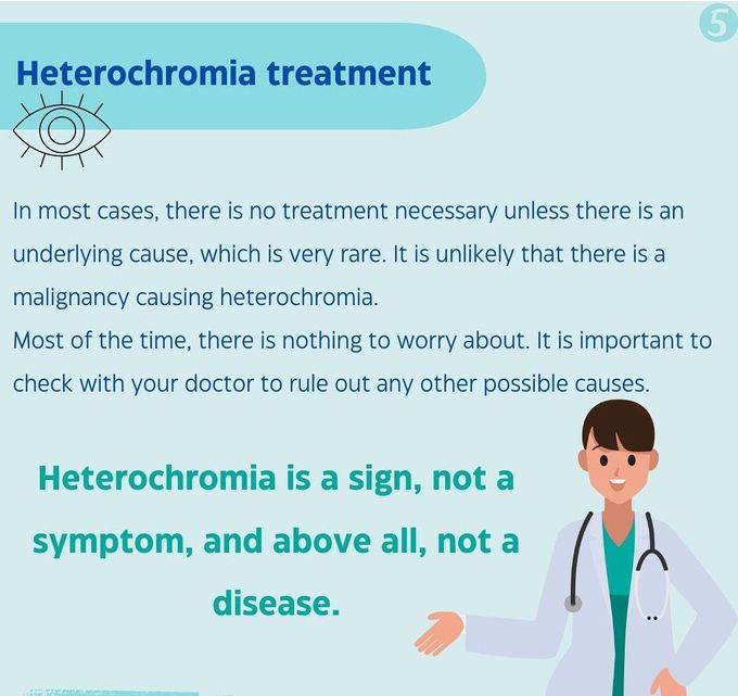 Heterochromia- Treatment