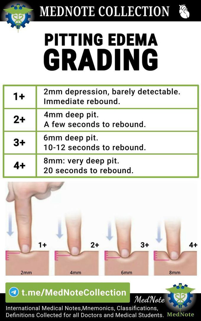 Edema grading