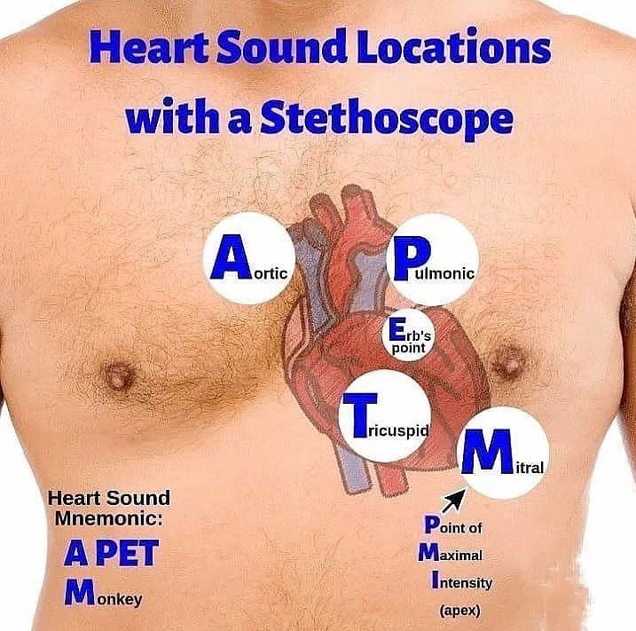 Heart Sound Locations With Stethoscope MEDizzy