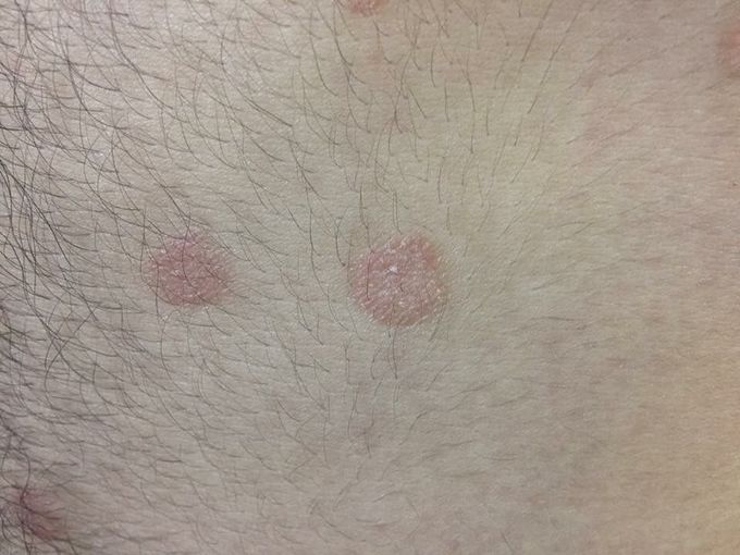 Any idea what's diagnosis and treatment?