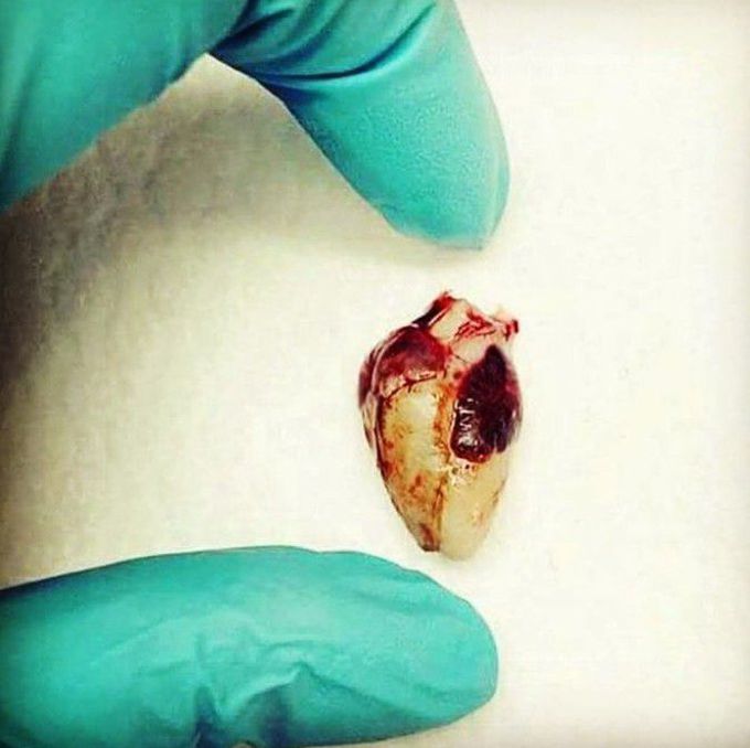 The heart of 20 weeks old fetus.
