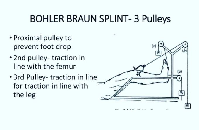 Bohler Braun Splint