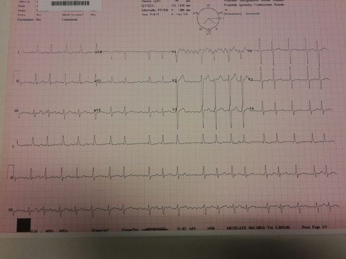 Diagnosis