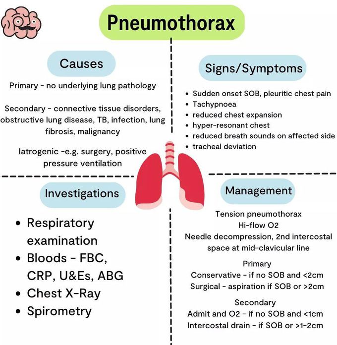 Pneumothorax