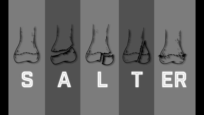 Salter Harris Fracture Classification