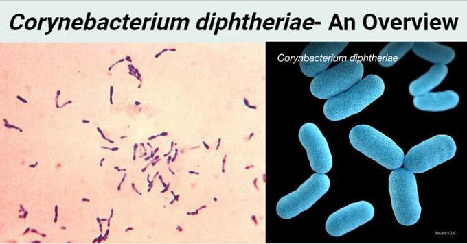 Cornyebacterium diptheriae