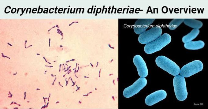 Cornyebacterium diptheriae - MEDizzy