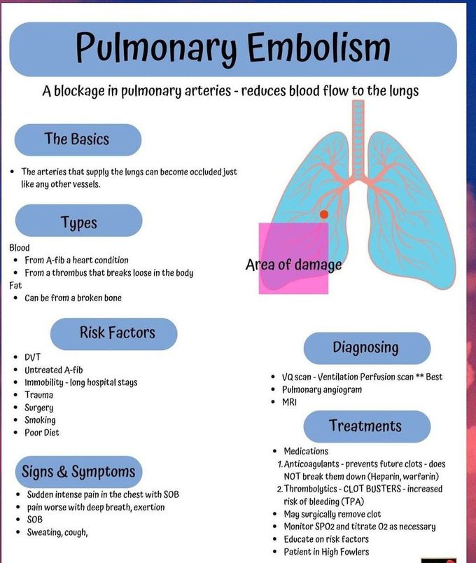 Pulmonary Embolism