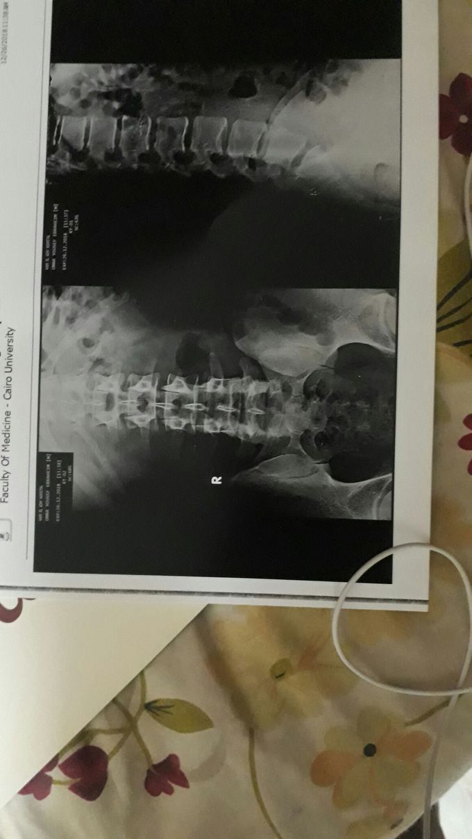 Diagnosis please