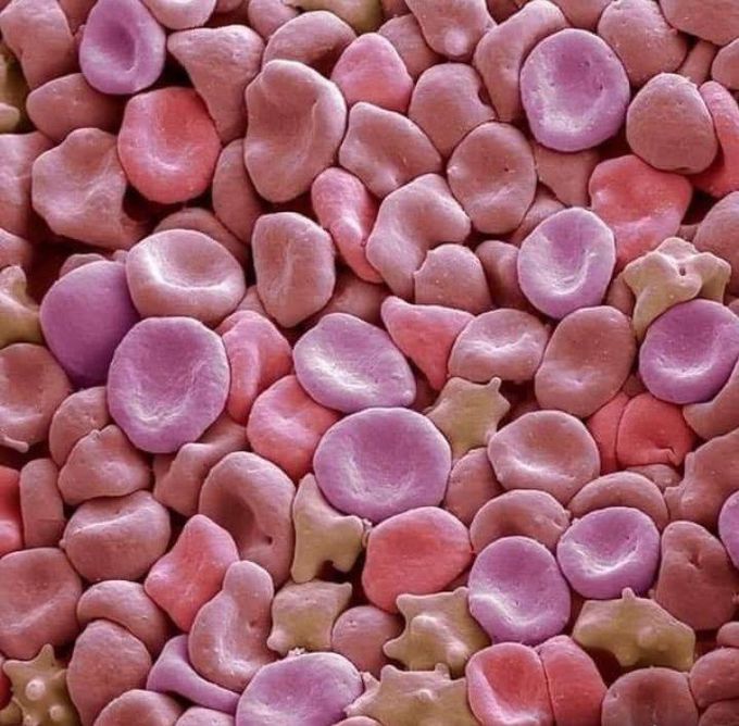 Red Blood cell (RBC's) captured with a scanning electron microscope.