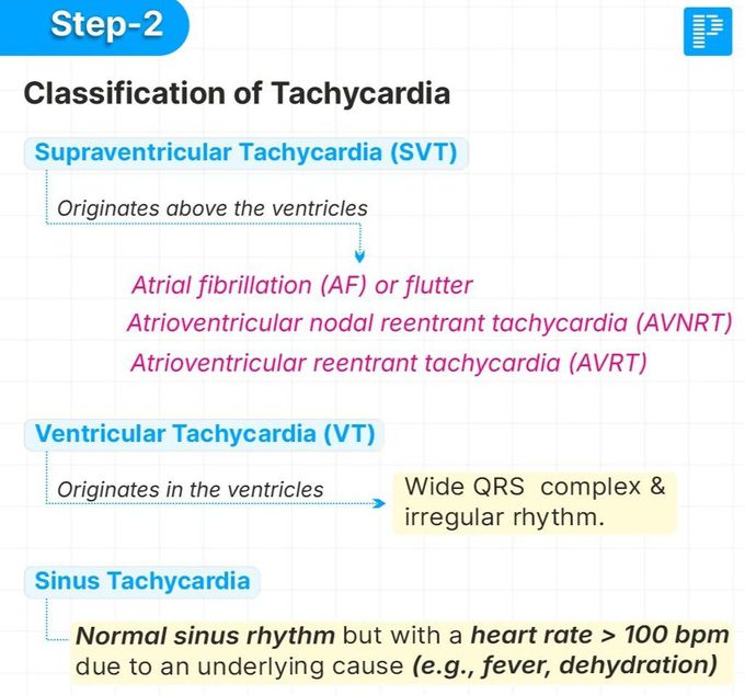 Tachycardia II