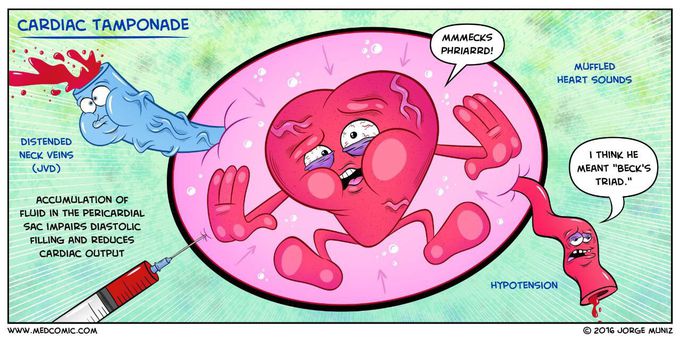 Cardiac tamponade