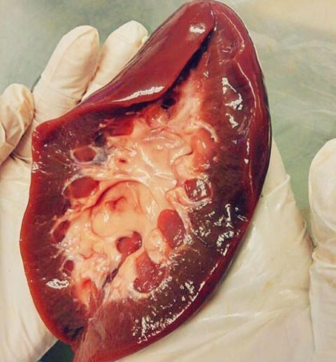 The inside of the kidney was never this clear! 