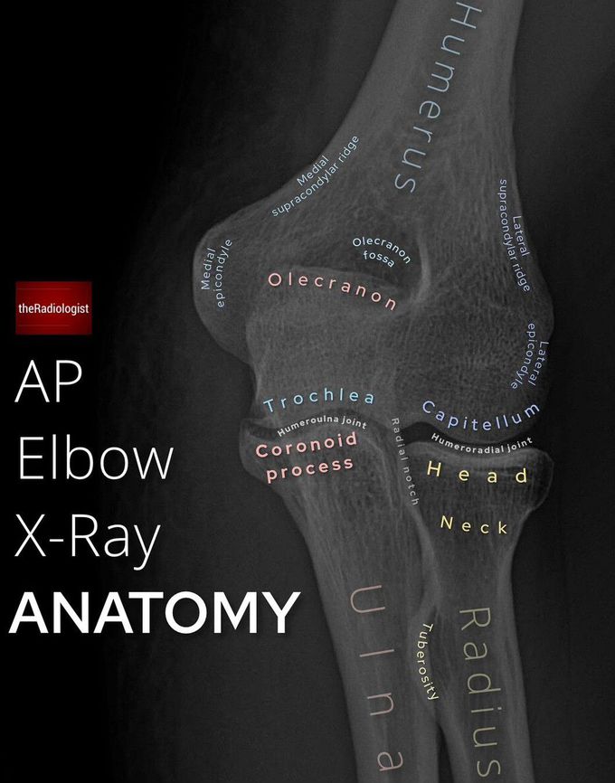 Upper Limb Anatomy IV