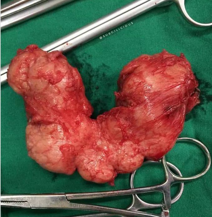 general surgery