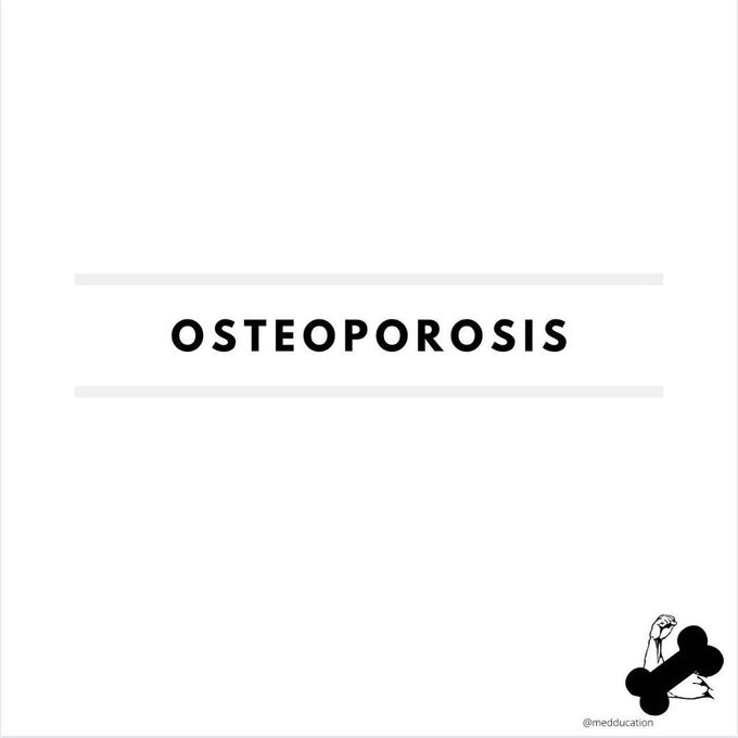 OSTEOPOROSIS