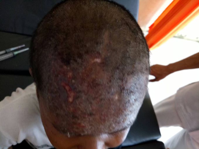 What is your diagnosis?