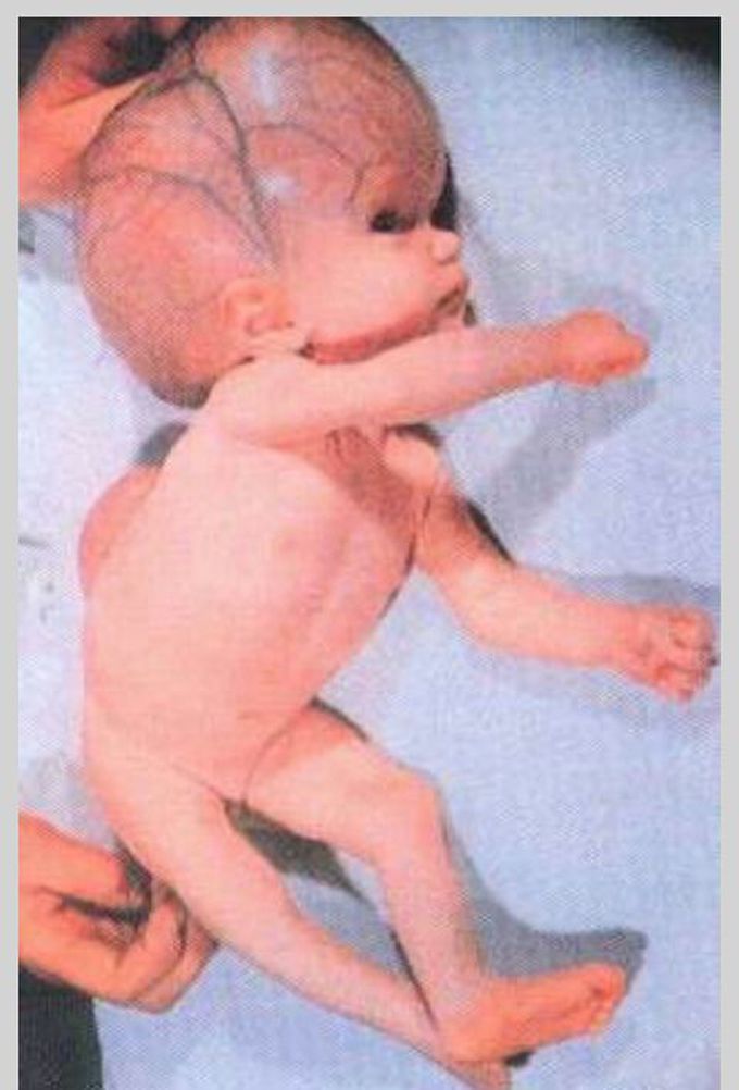 What is the diagnosis?