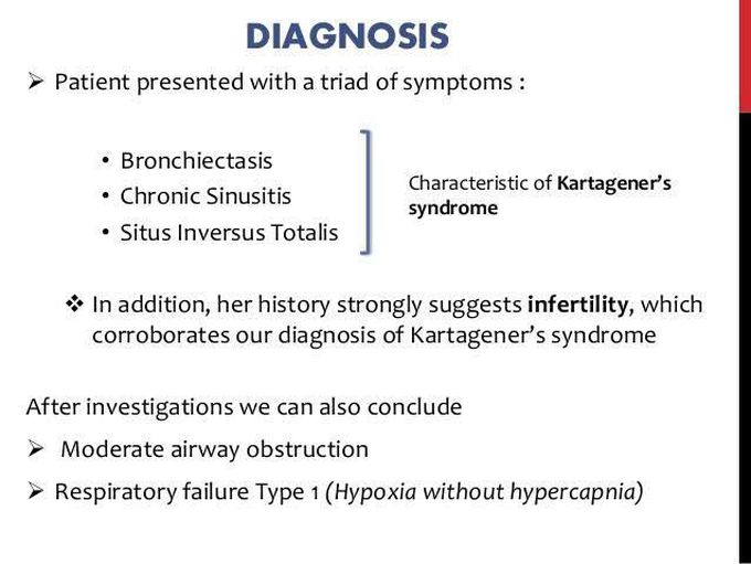 Kartagener syndrome diagnosis