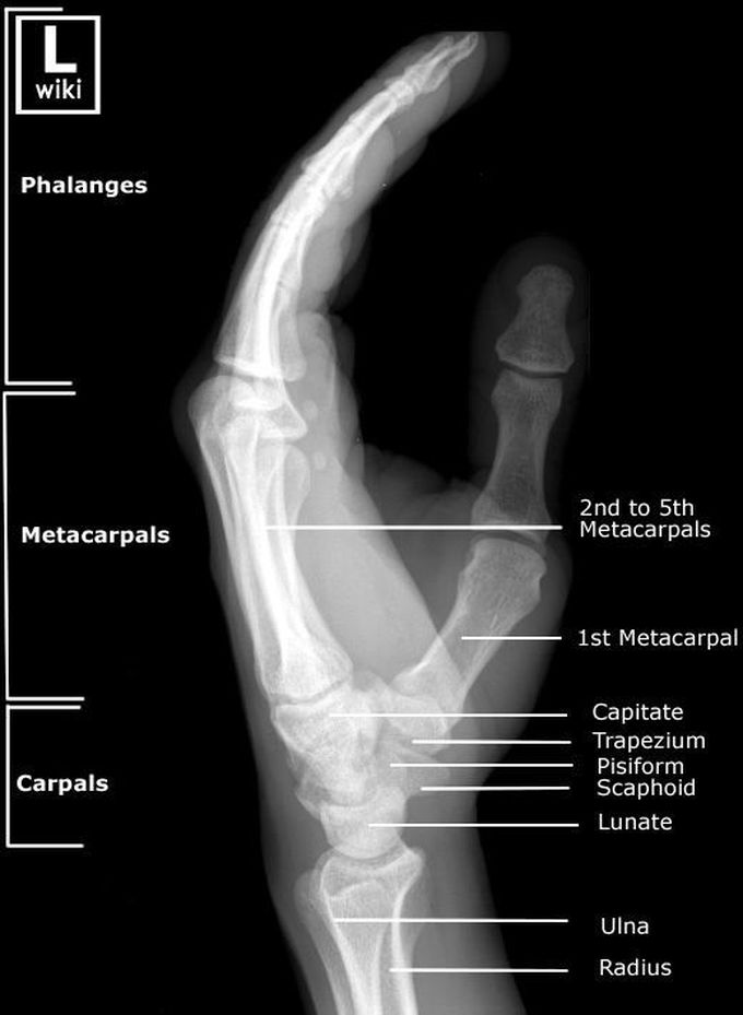 Hand Radiographic Anatomy