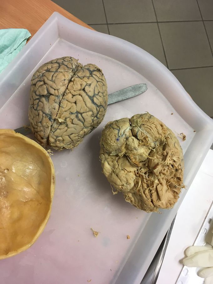 Human Brain