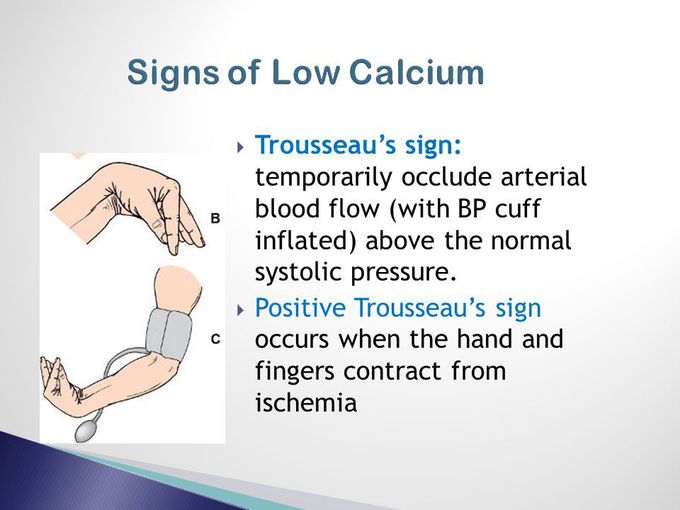 Hypocalcemia