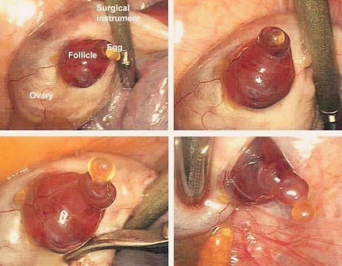 Ovulation