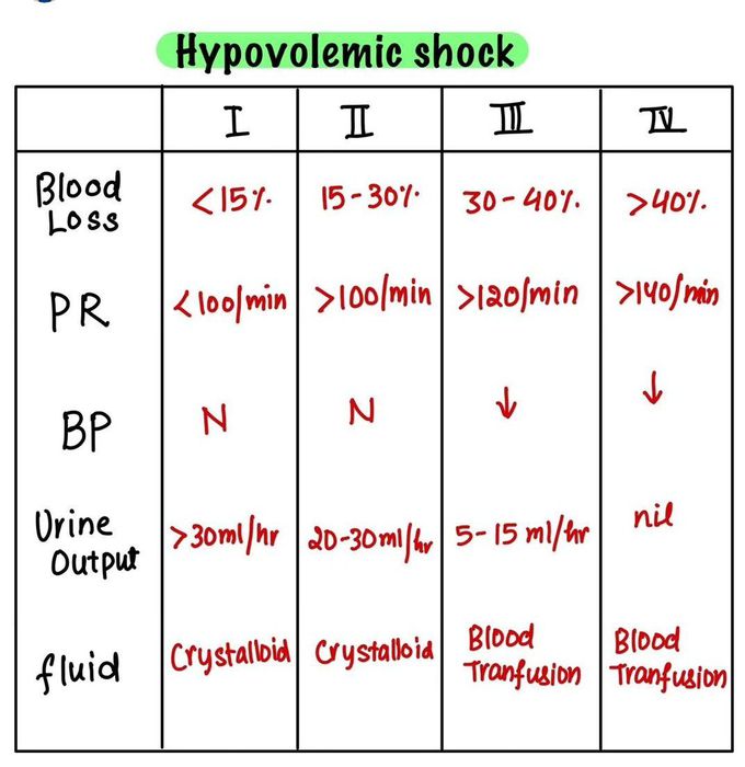 Hypovolemic Shock