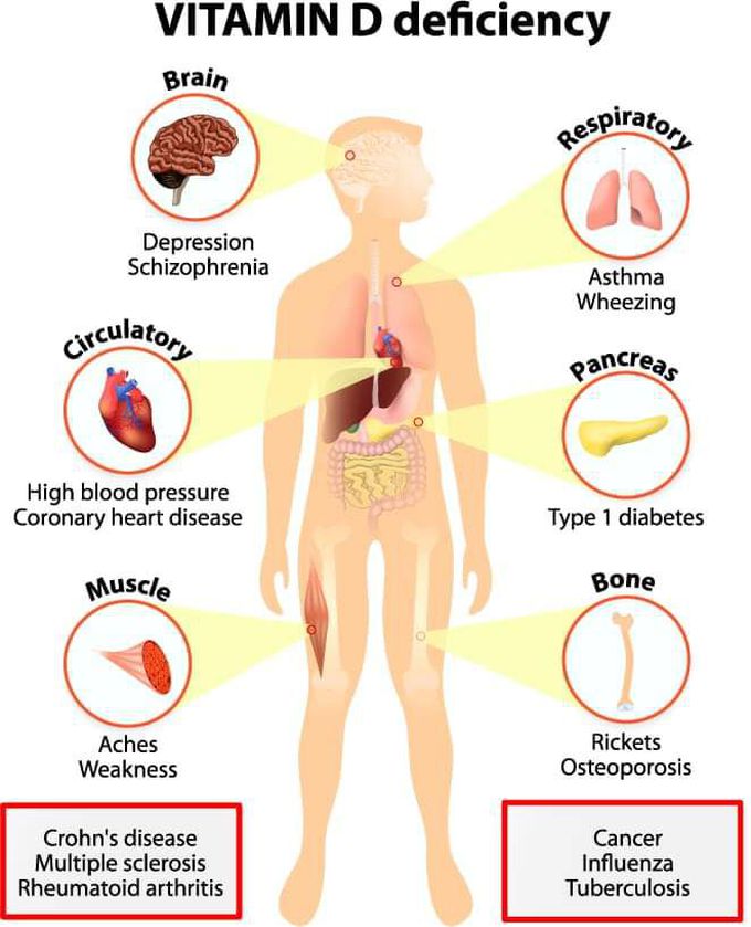 Vitamin D