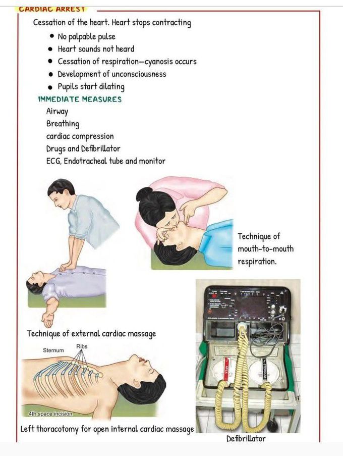 Immediate Measures for Cardiac Arrest