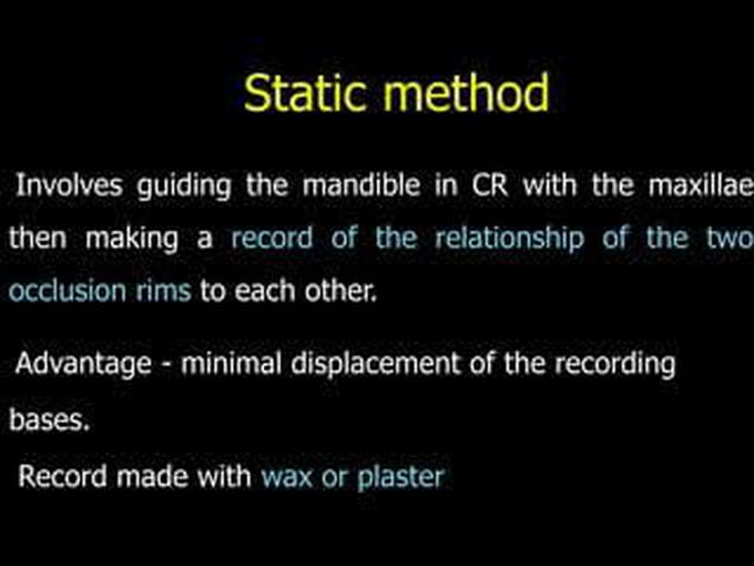 Static Method
