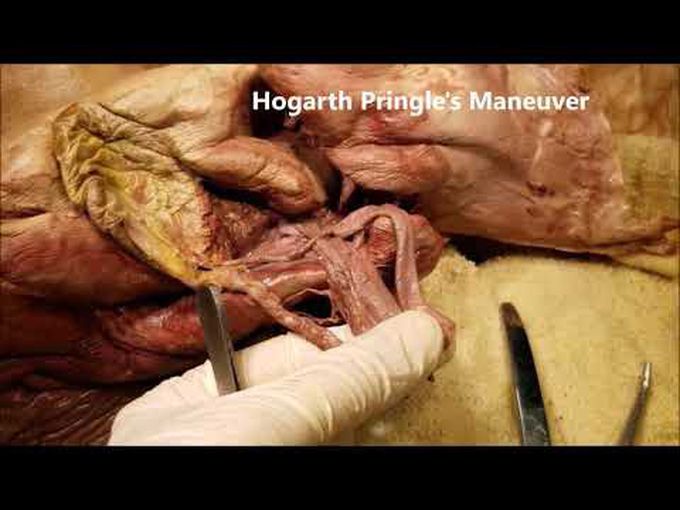Anatomy of Porta Hepatis