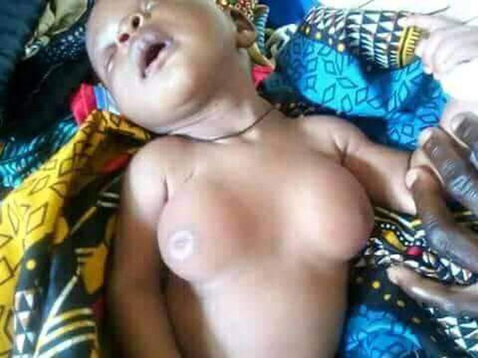Case of new born