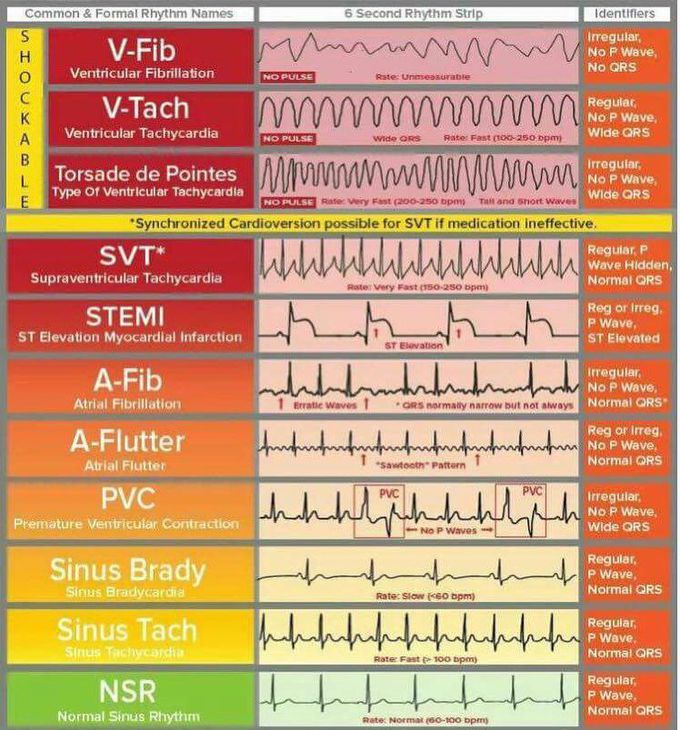 Heart Rhythms