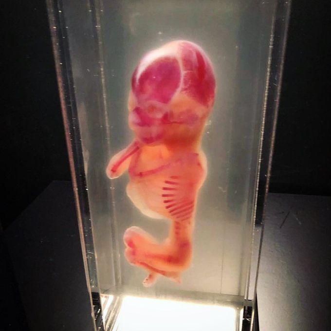 Preserved dyed human fetus!