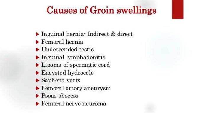 Causes of femoral hernia