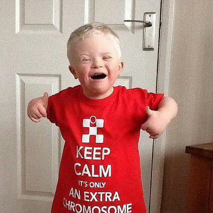 Just an extra chromosome so KEEP CALM!