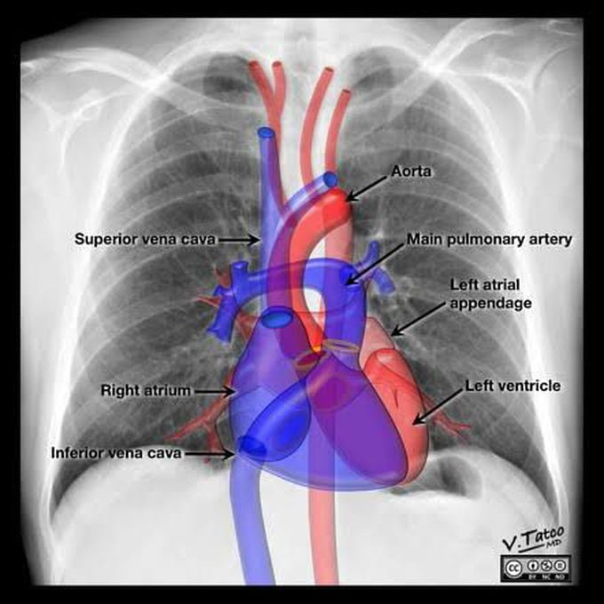 Heart