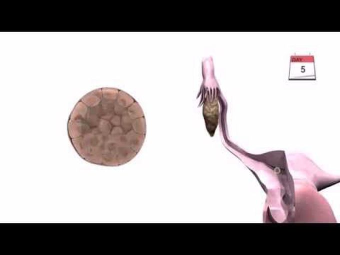 Animation About Implantation