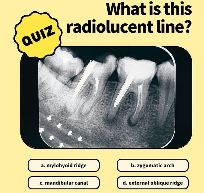 Identify the Structure