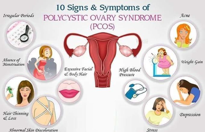 Signs of PCOS(Polycystic Ovarian Syndrome)