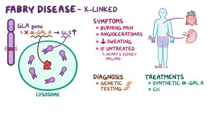 Fabry disease treatment