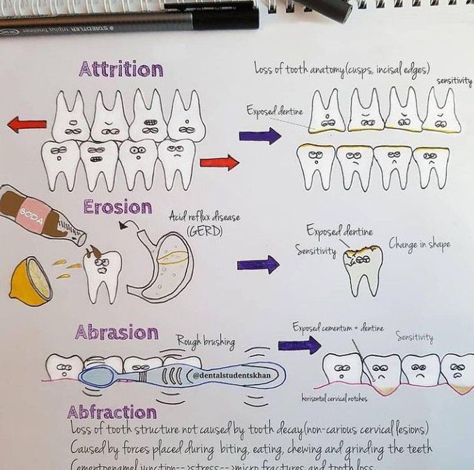 Tooth loss
